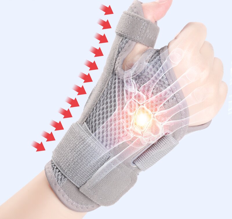 腕关节.jpg